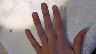This is the first step of many required to get acrylic nails. Nails have been cut down and sanded so the hardening material can tack onto the natural nail.  The process can be very damaging and rough on your real nails, in the end it is worth it because they look nice and the nail will go back to normal,junior Madi Gackstetter says. 